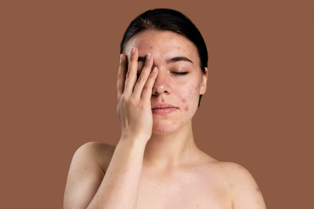 Dark Spot Care